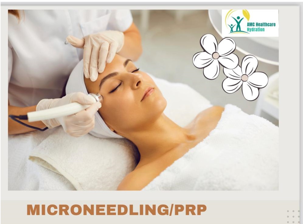 Microneedling